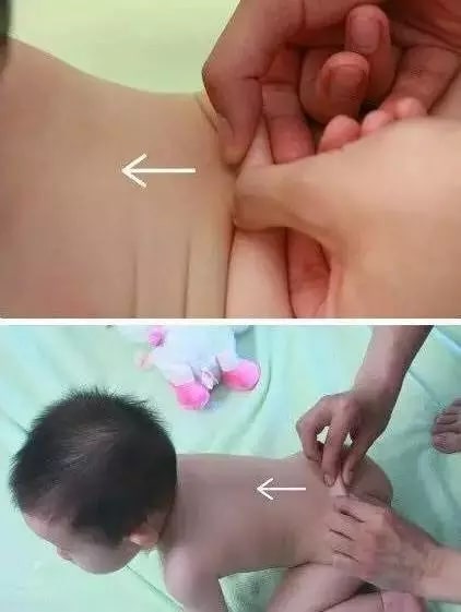 實用的小兒推拿方法圖文教程