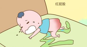 寶寶紅屁屁怎么辦