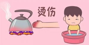 寶寶不小心燙傷了怎么辦？記住這五字訣