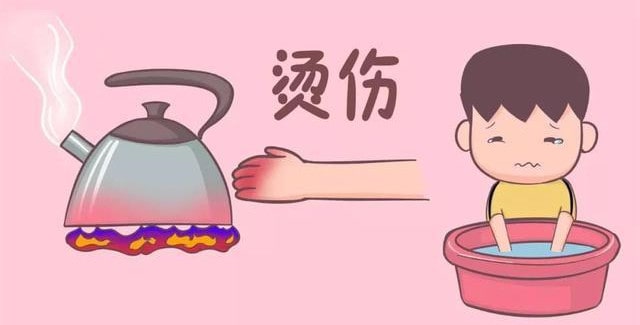 寶寶不小心燙傷了怎么辦？記住這五字訣