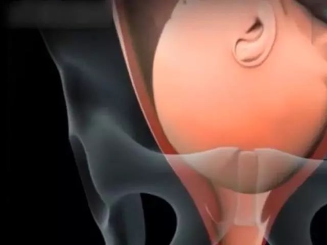 孕婦順產(chǎn)過程是怎么樣的