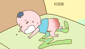 寶寶紅屁股怎么辦