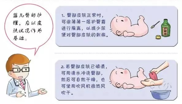 寶寶紅屁股怎么辦