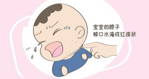嬰兒淹脖子怎么辦