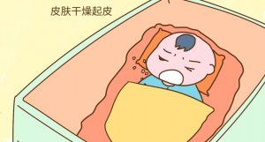 新生兒冬季皮膚干燥怎么辦