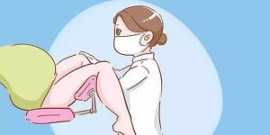 陰超檢查什么