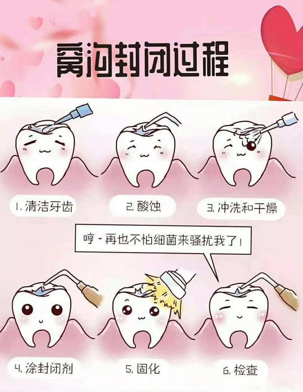 牙齒窩溝封閉是什么意思