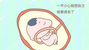 臍帶繞頸一般會(huì)發(fā)生在胎兒發(fā)育的第幾個(gè)月？