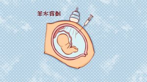羊水穿刺，你問我答