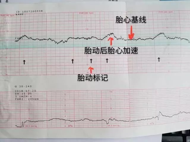 孕期必做的5次產(chǎn)檢項(xiàng)目