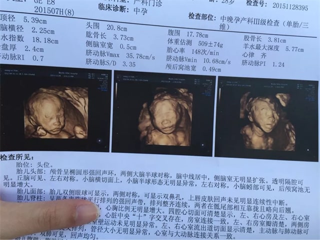 孕期必做的5次產(chǎn)檢項(xiàng)目
