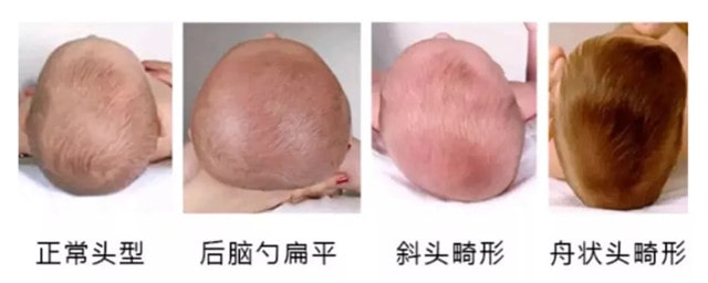 新生兒需要枕頭嗎