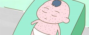嬰兒急疹癥狀及處理