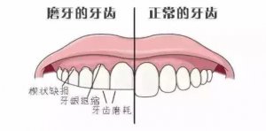 小孩晚上睡覺(jué)磨牙的危害