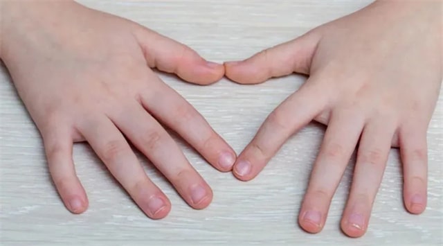 寶寶指甲透露的5種健康信號