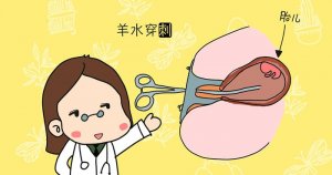 高齡產(chǎn)婦的檢查項(xiàng)目