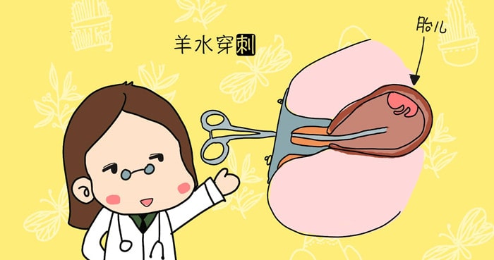 高齡產(chǎn)婦的檢查項目