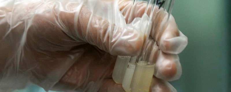 如何判斷精液是否正常