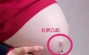 孕婦肚臍有凹有凸，和生男生女有關(guān)？