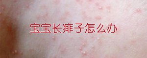 寶寶長(zhǎng)痱子怎么辦