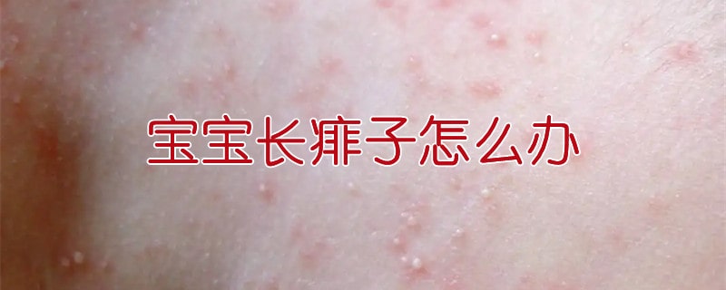 寶寶長(zhǎng)痱子怎么辦